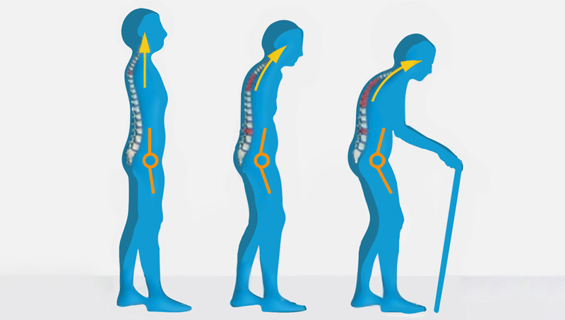 Figure 1 - As we age, our posture becomes increasingly more stooped (yellow arrows) leading to a reduction in hip angle (orange lines) and corresponding joint movement, and a shortened stride length. [7]